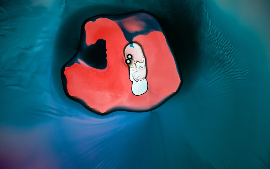 Photo Nosebleed diagram