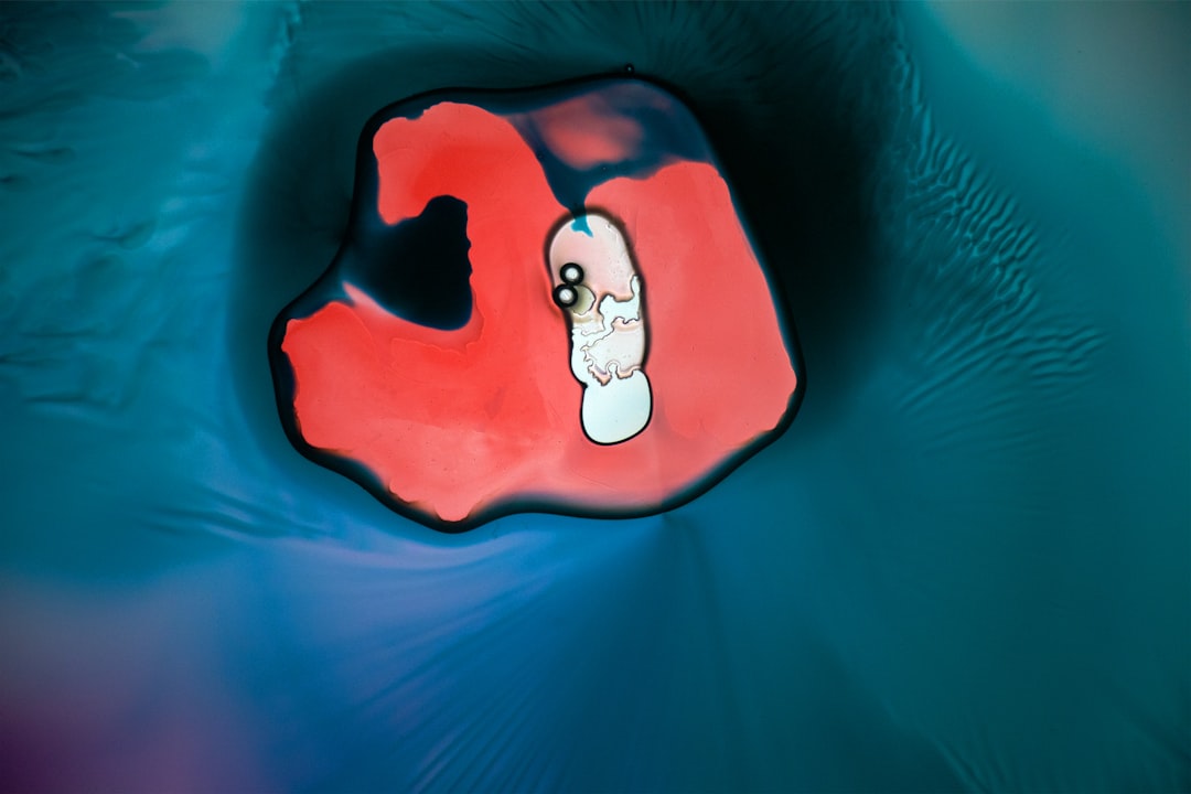 Photo Nosebleed diagram