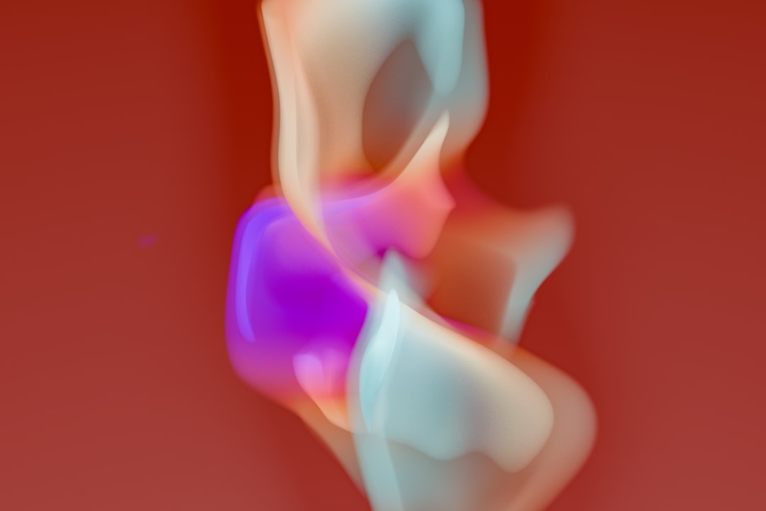 Photo Nosebleed diagram
