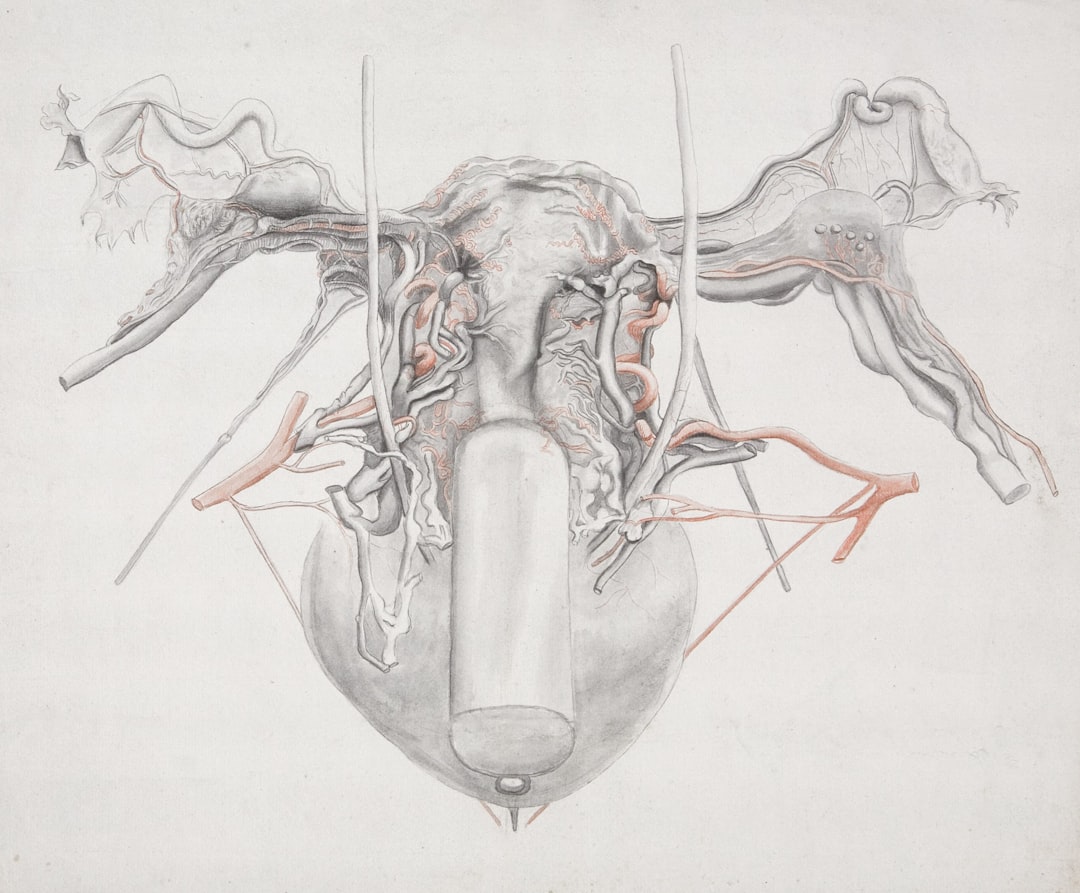 Photo Nosebleed diagram