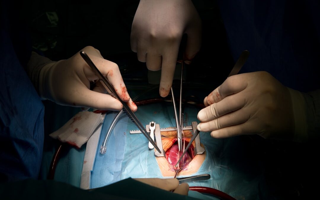 Photo Surgical removal