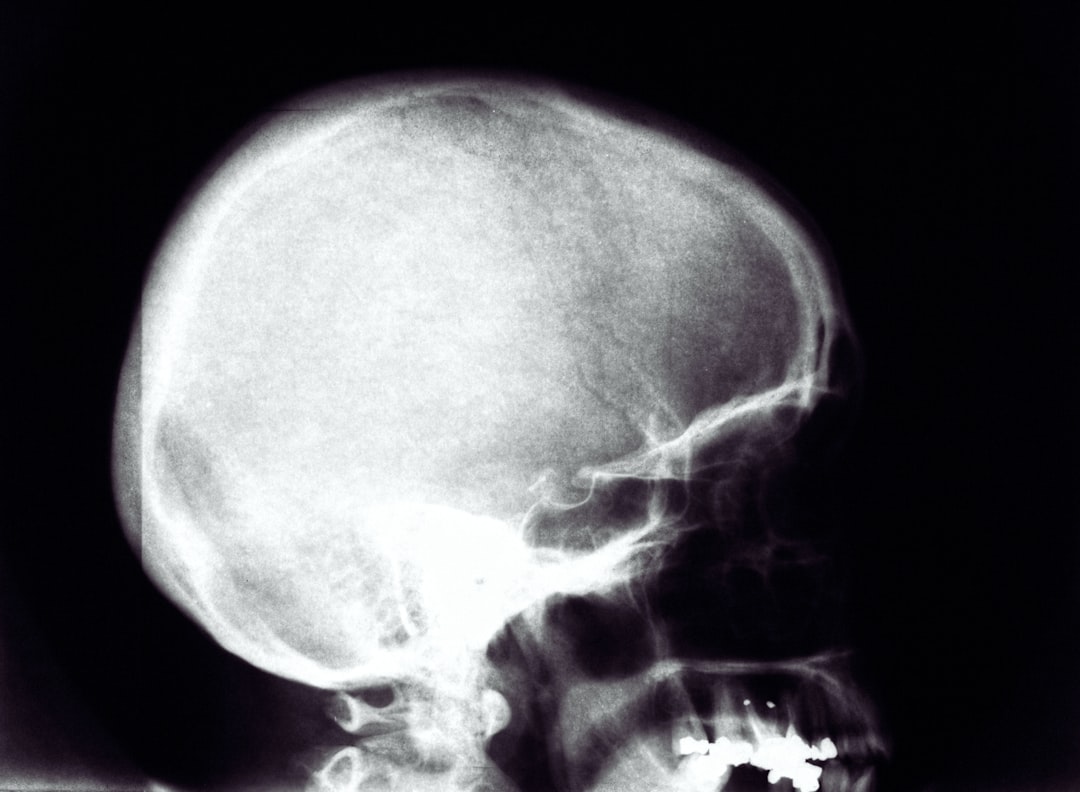 Photo X-ray scan