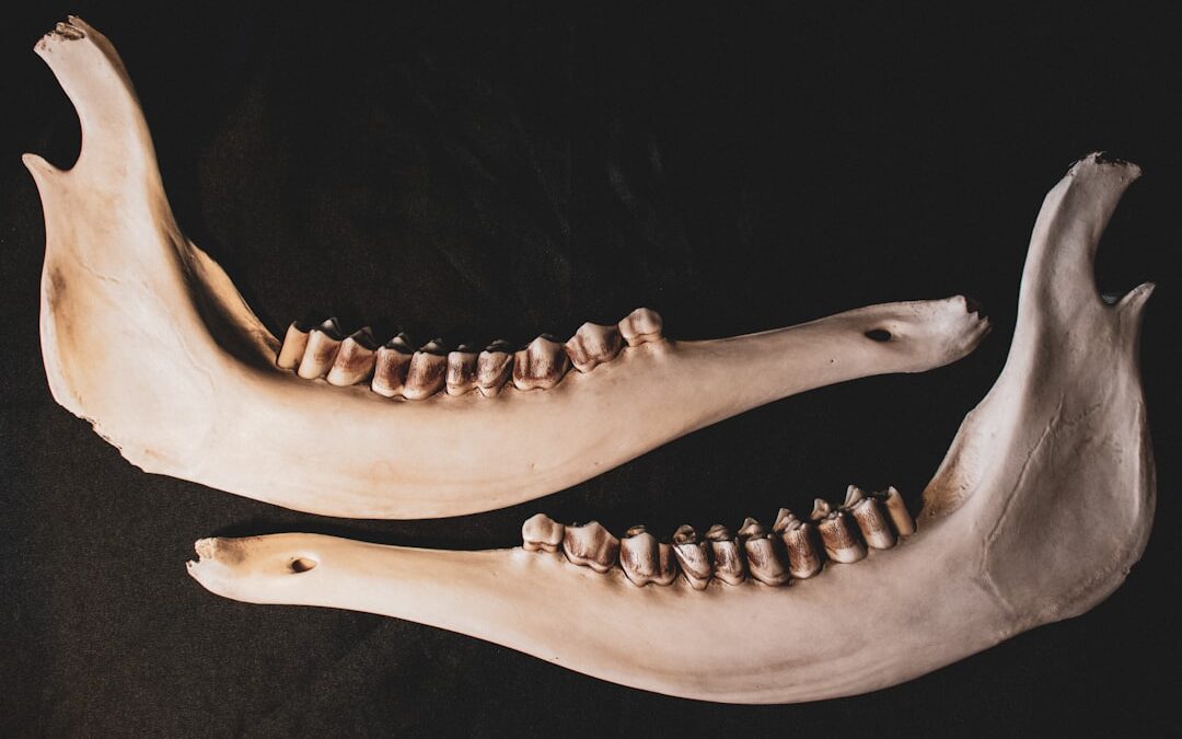 Photo Bone structure