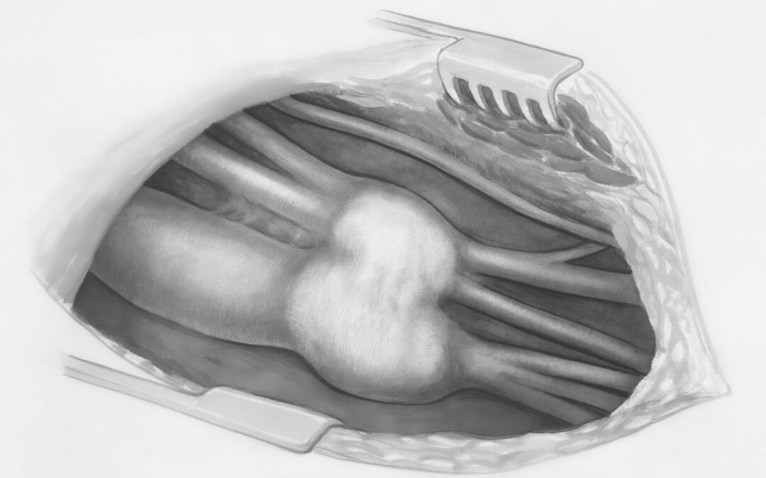 Photo X-ray image