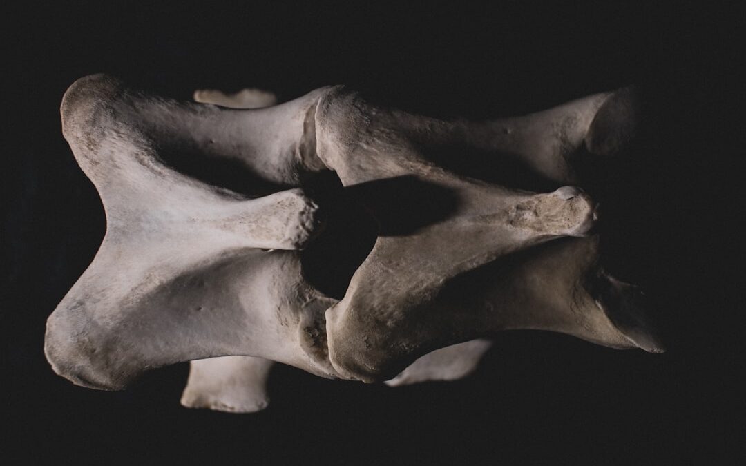 Photo Bone tumor