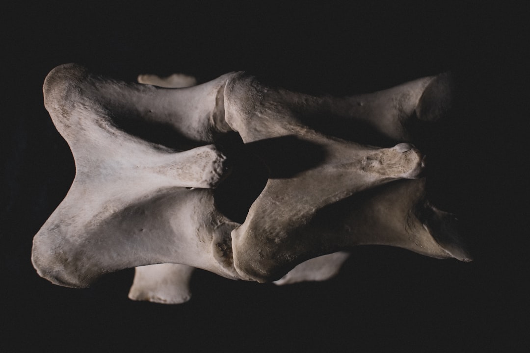Photo Bone tumor