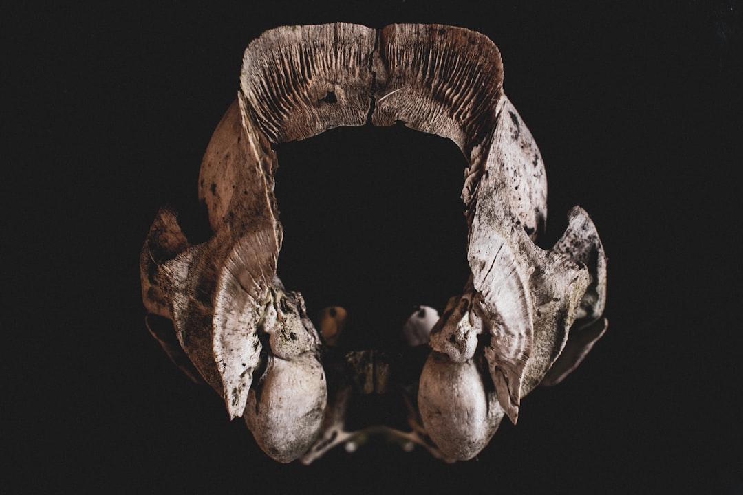 Photo Bone tumor