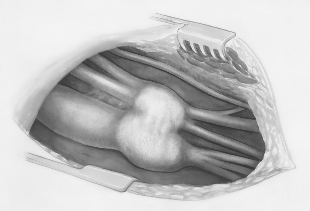 Photo X-ray image