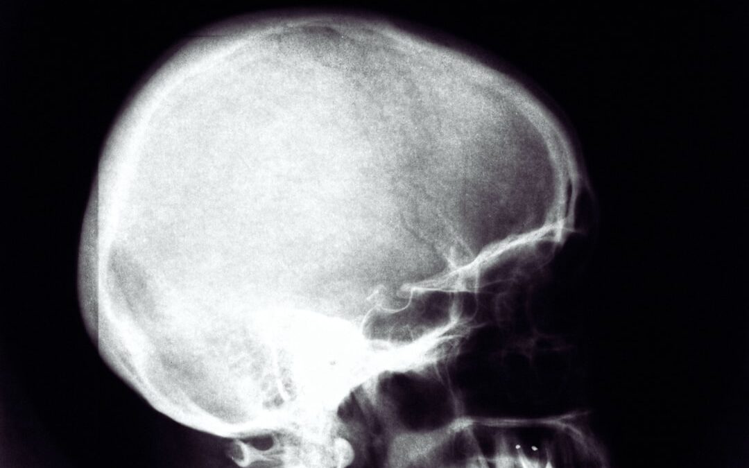 Photo X-ray scan