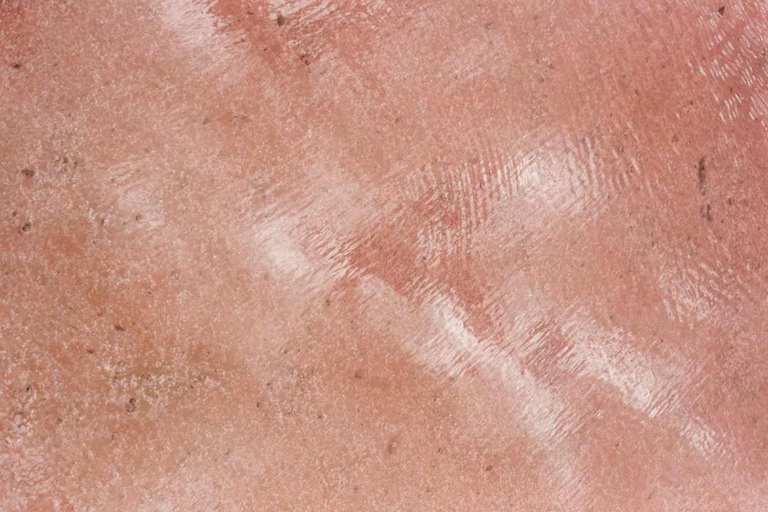 Photo Skin irritation