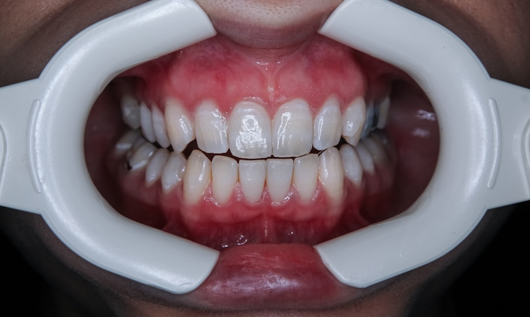 Photo Teething baby
