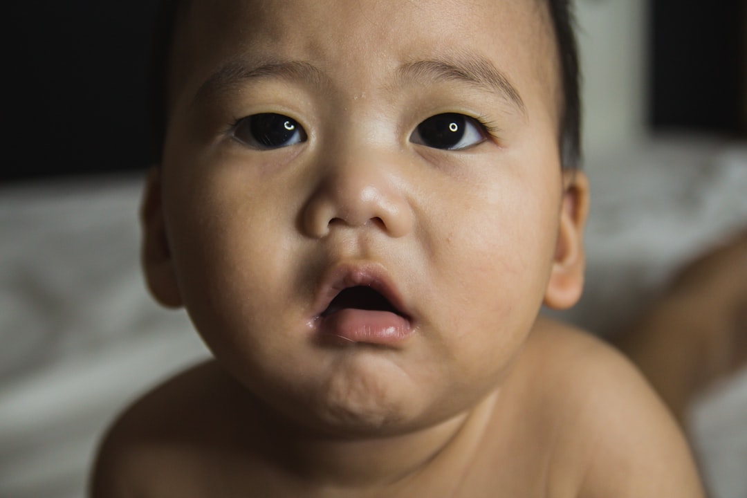 Photo Baby with rash