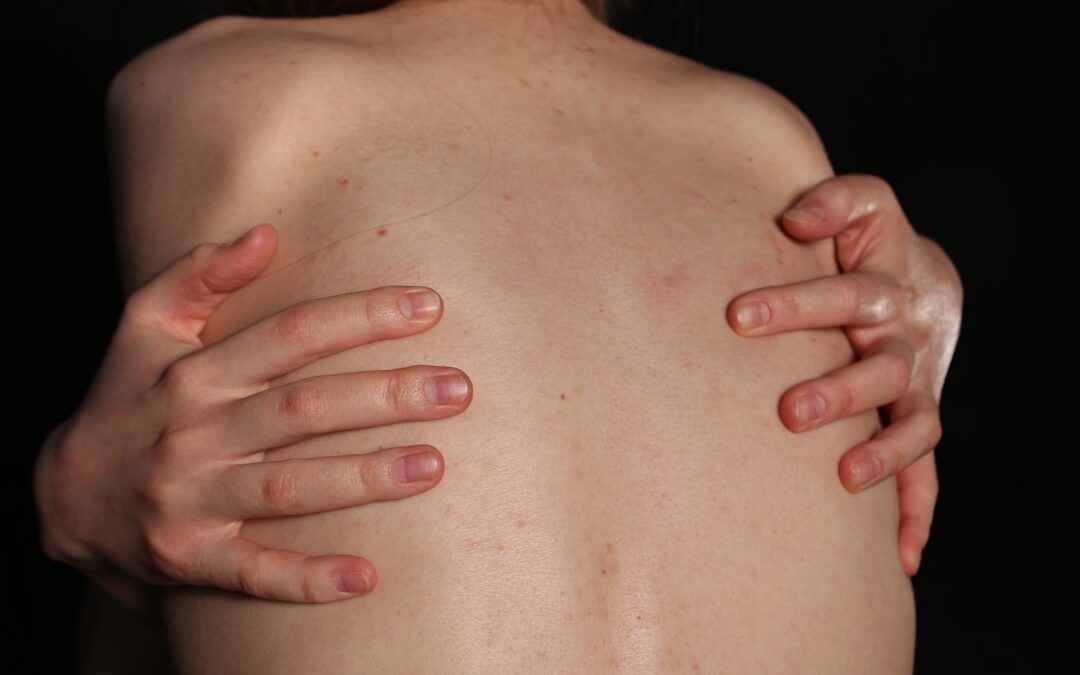 Photo Itchy skin