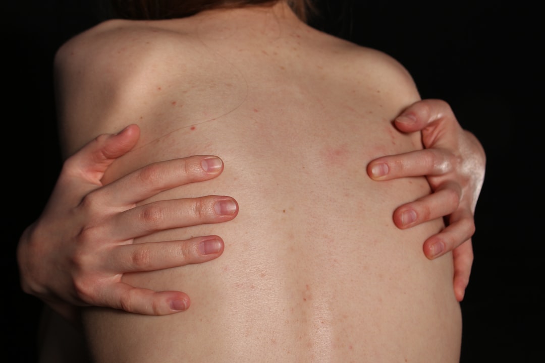 Photo Itchy skin