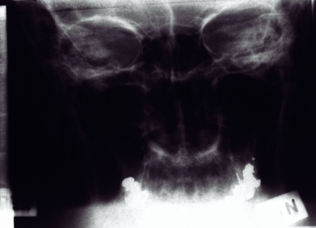 Photo Bone scan