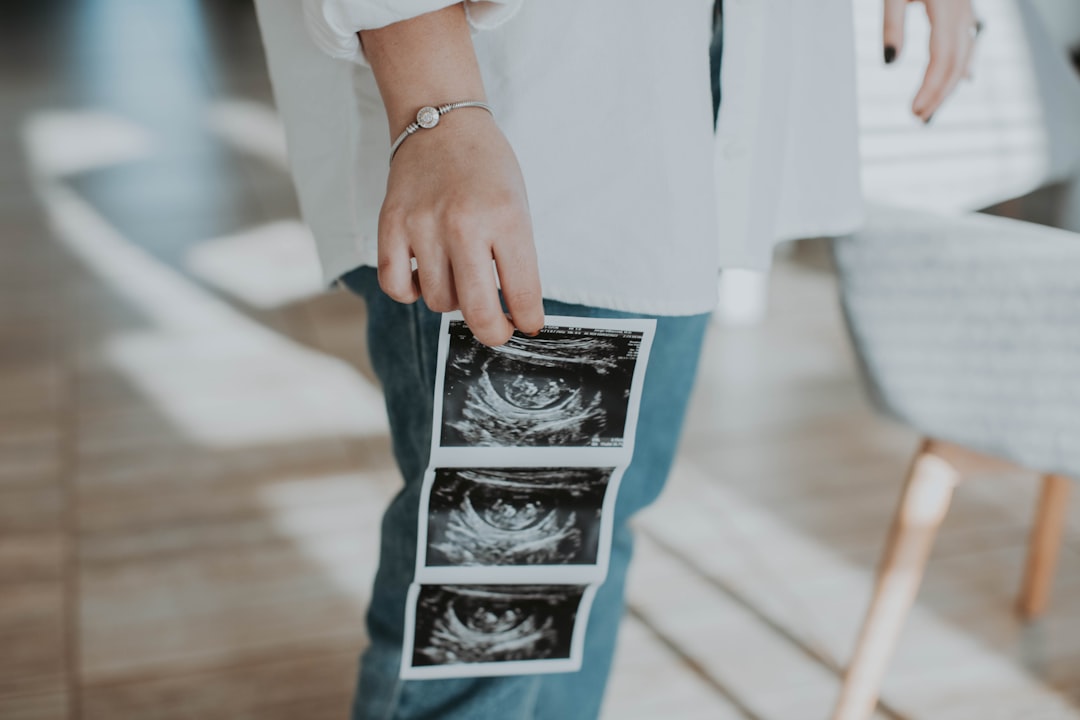 Photo Ultrasound scan
