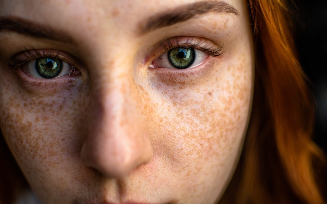 Photo Redness and swelling