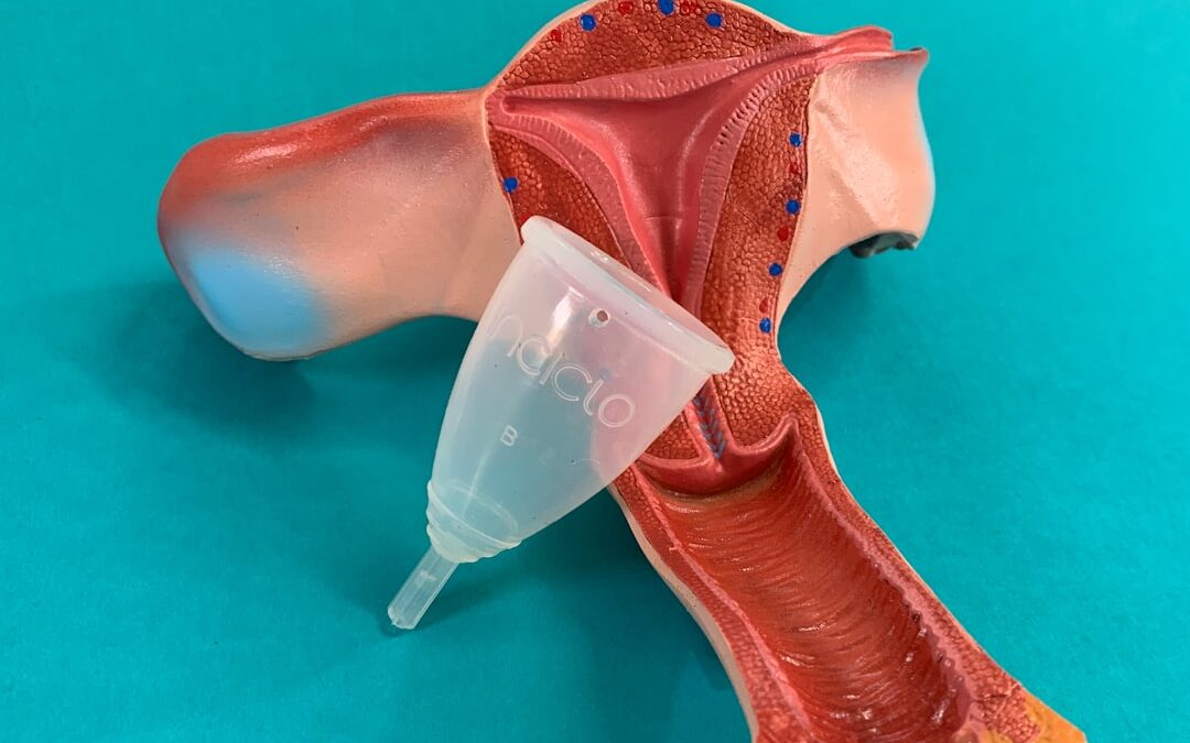 Photo Thyroid gland