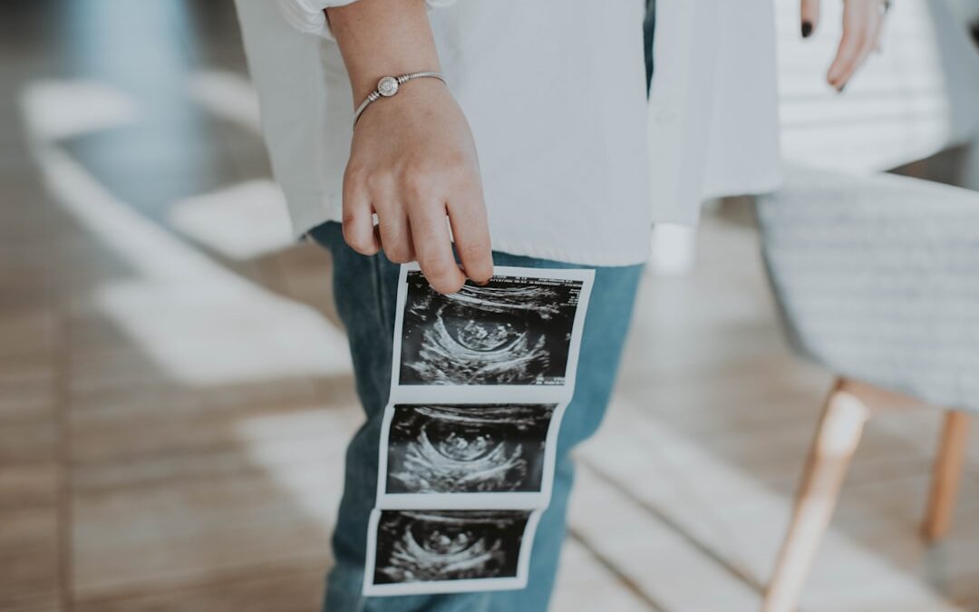 Photo Ultrasound scan