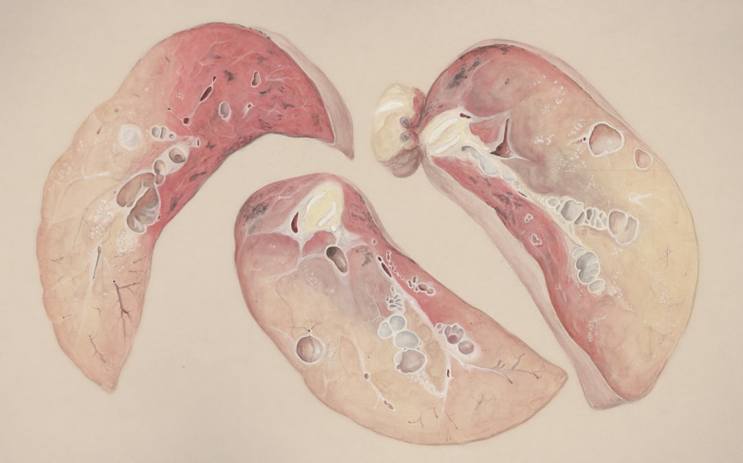 Photo Kidney diagram