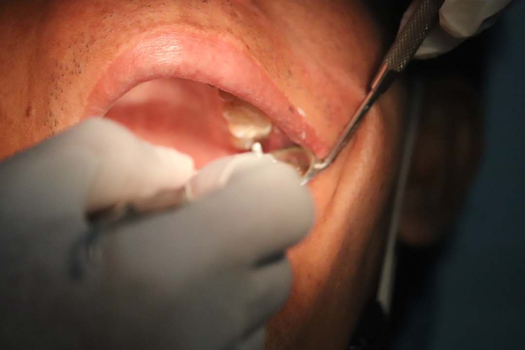 Photo Oral lesions