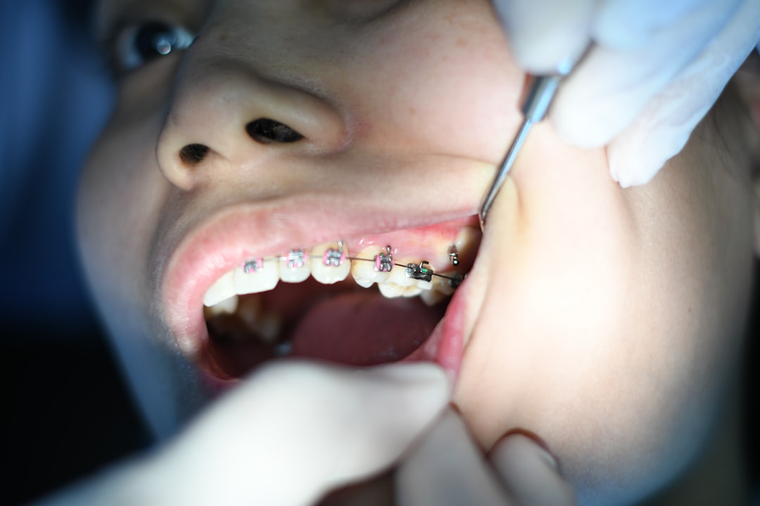 Photo Oral lesions