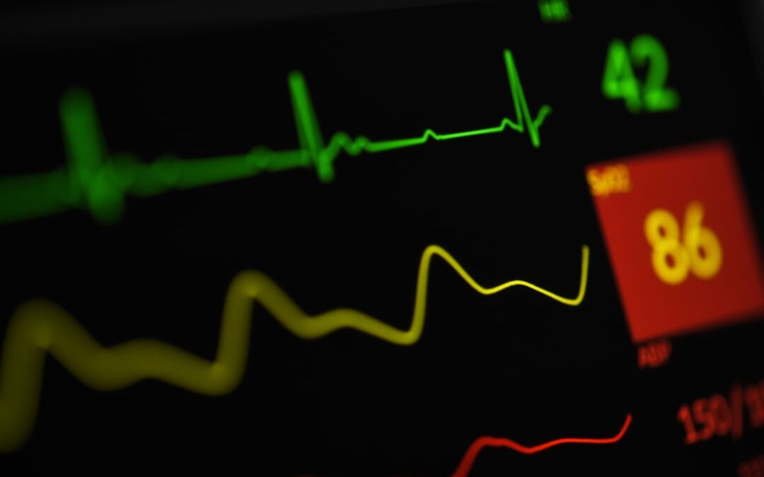 Photo Electrocardiogram