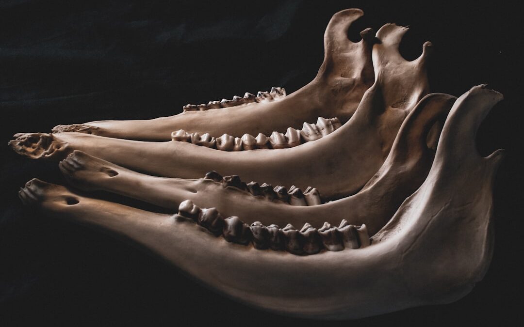 Photo Foot X-ray