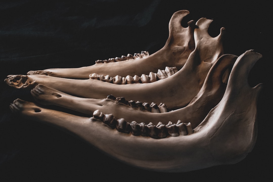 Photo Foot X-ray