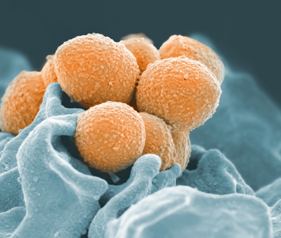 Photo Bacterial pneumonia