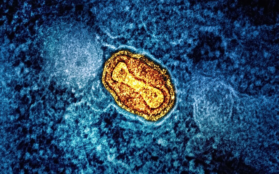 Photo Stomach virus