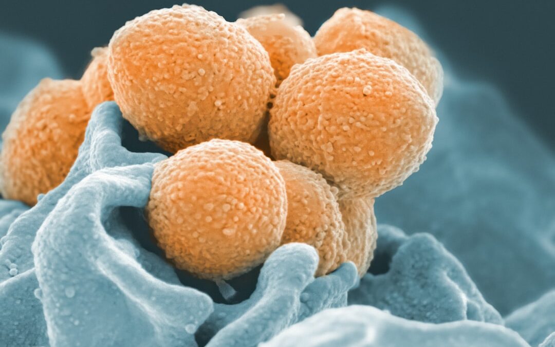 Photo Bacterial infection