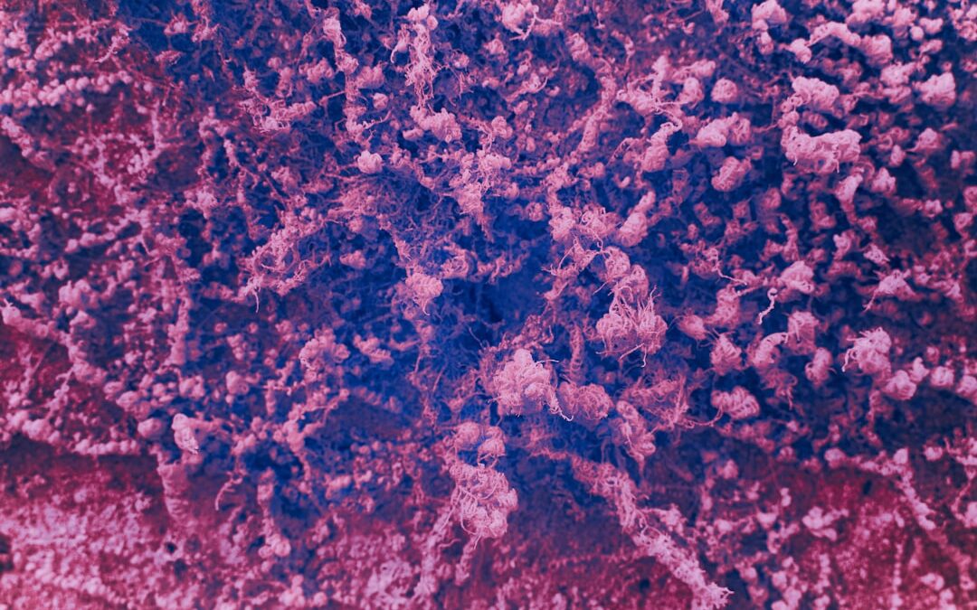 Photo Bacterial pneumonia