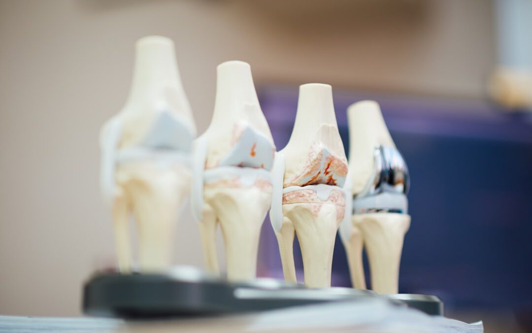 Photo Joint pain