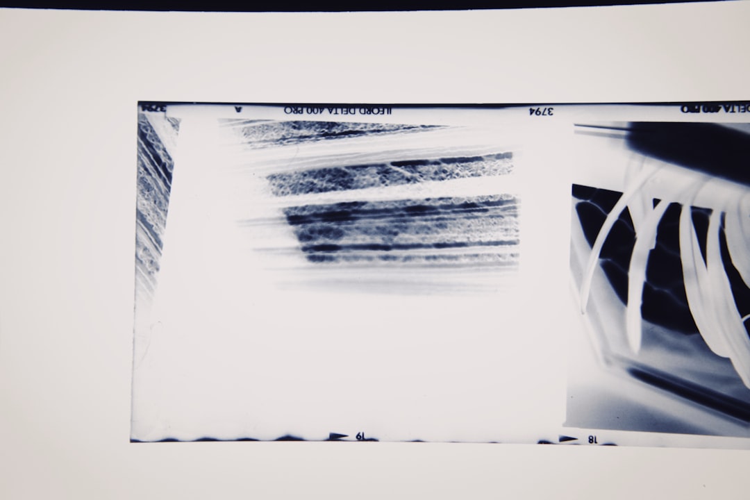 Photo X-ray image