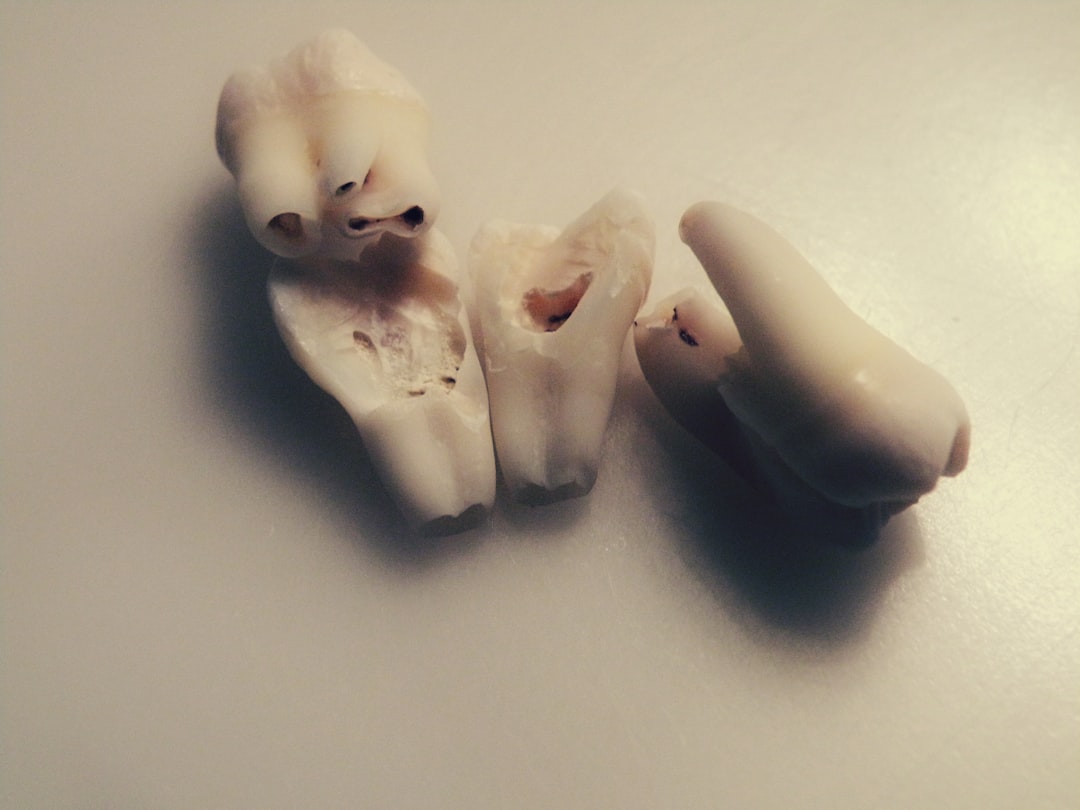 Photo Dental X-ray