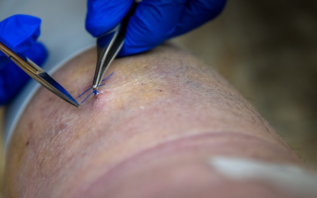Photo Surgical incision