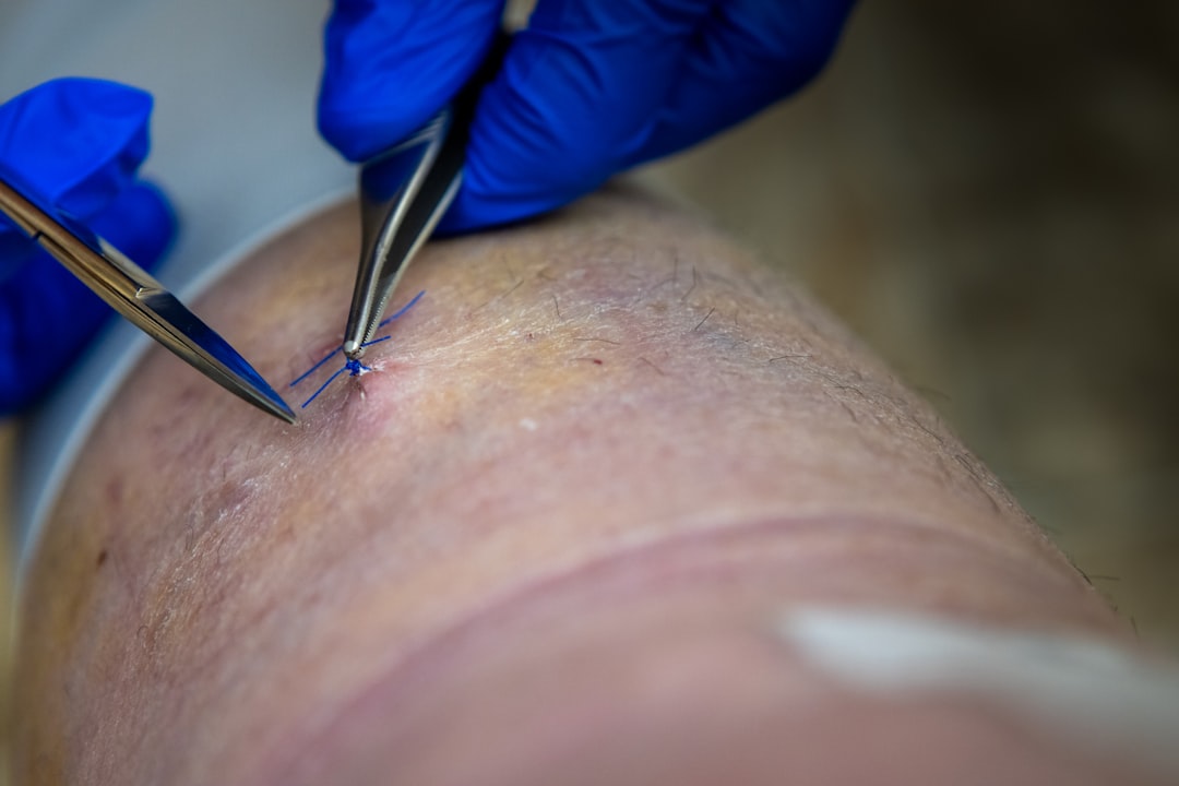 Photo Surgical incision