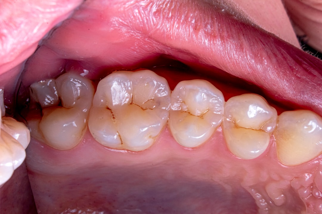 Photo Swollen tonsils