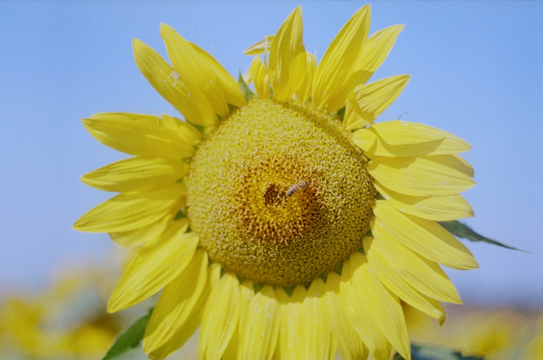 Photo Sunburn relief