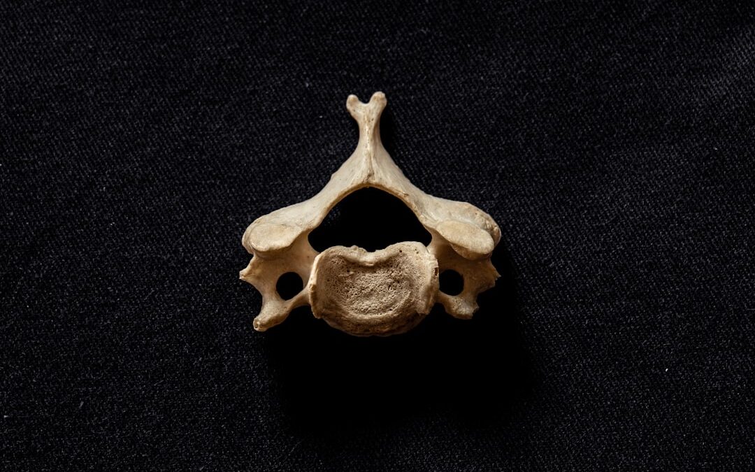 Photo Spinal cord