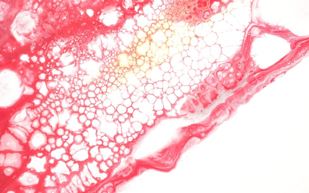 Photo Swollen lymph nodes