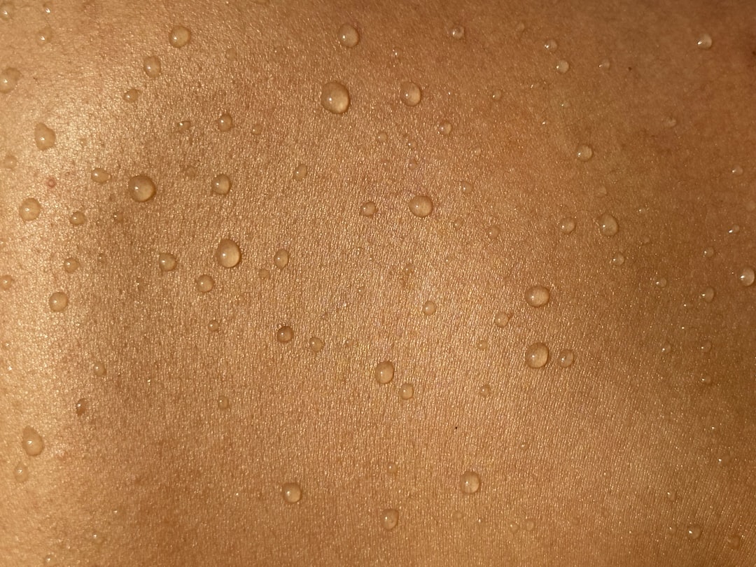 Photo Holyagos napeges: skin irritation