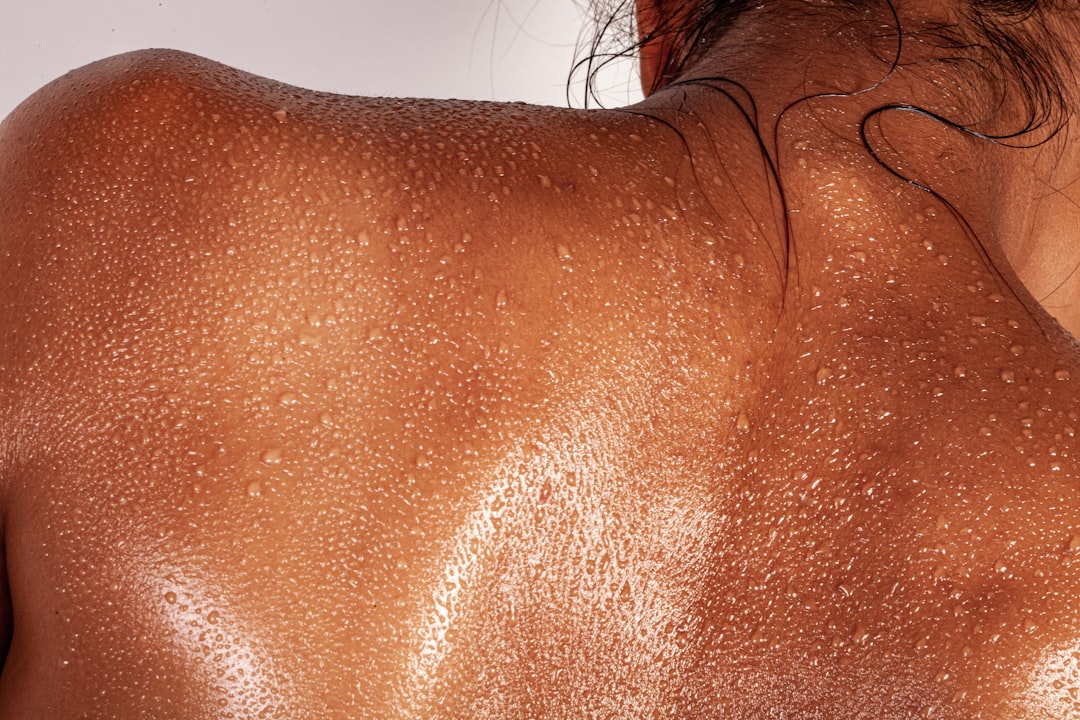 Photo Symptoms: Skin rash