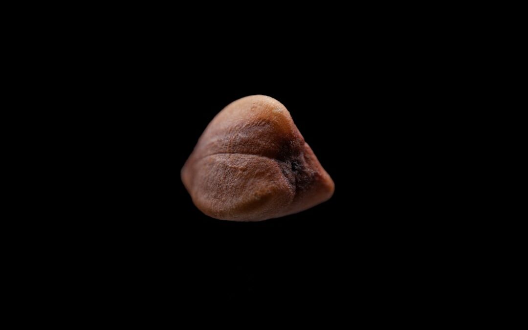 Photo Prostate gland