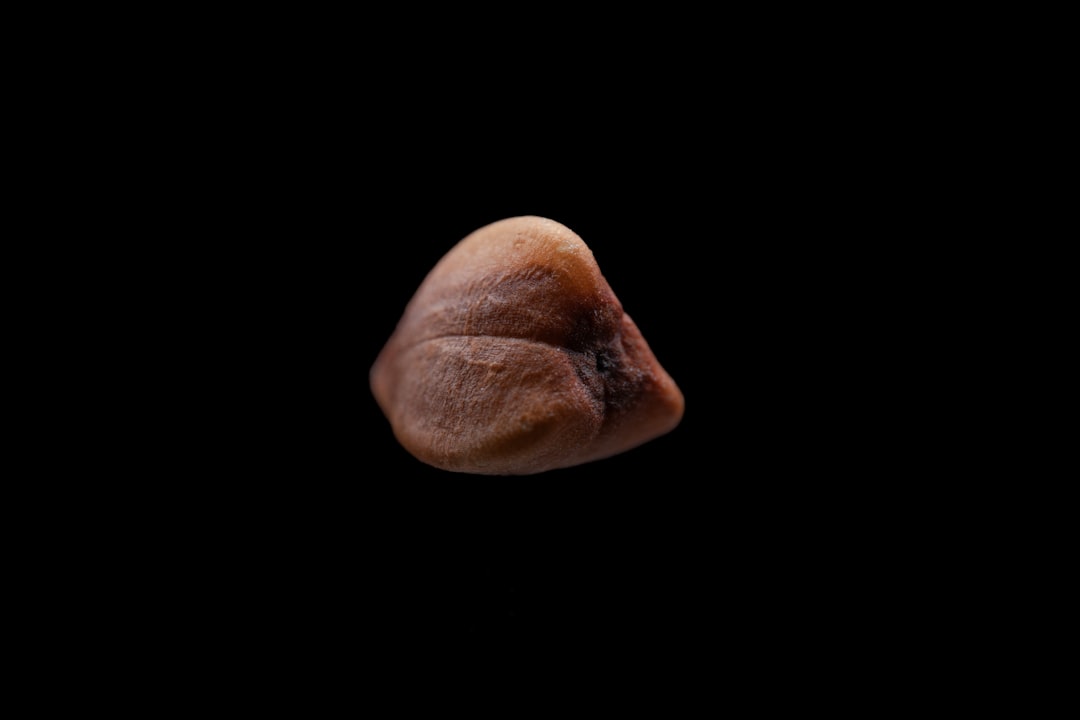 Photo Prostate gland