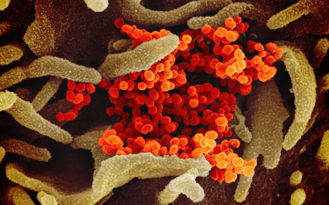 Photo Prostate bacteria