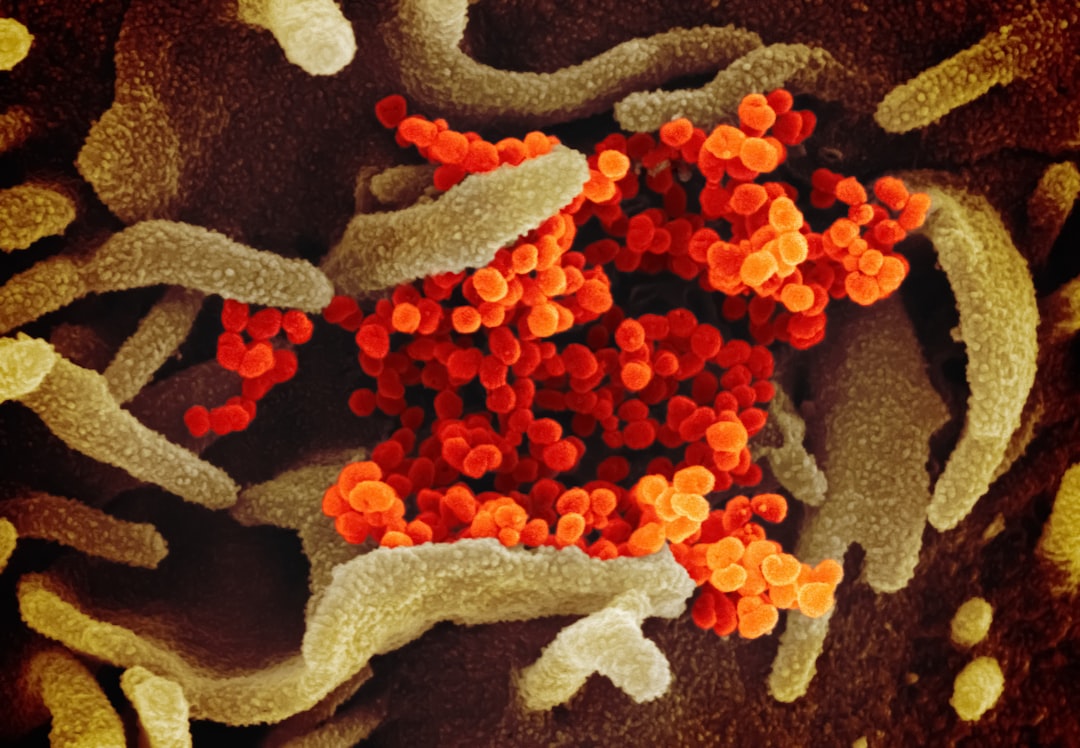 Photo Prostate bacteria