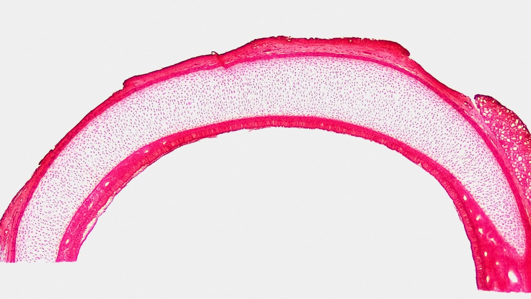 Photo Prostate diagram