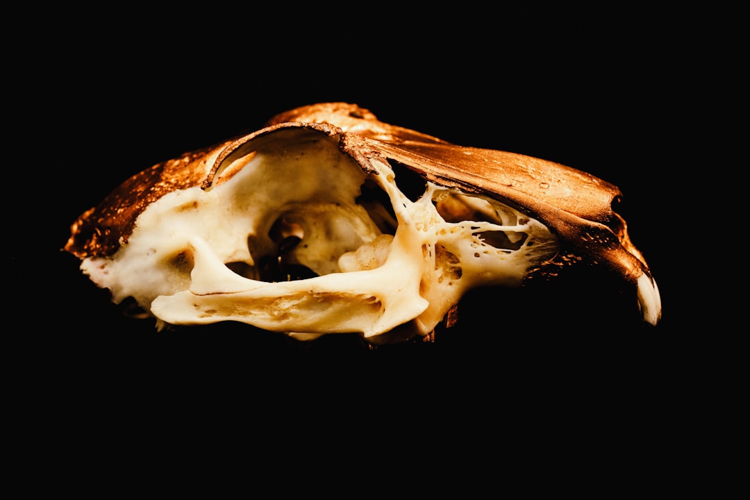 Photo Prostate anatomy